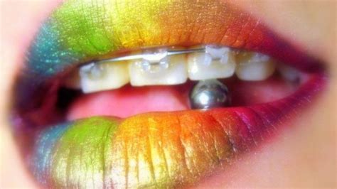 besos arcoiris|El beso arcoíris, por qué es tan peligroso practicarlo